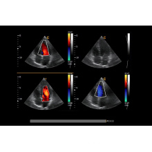 Hotselling 4D portátil Color Doppler